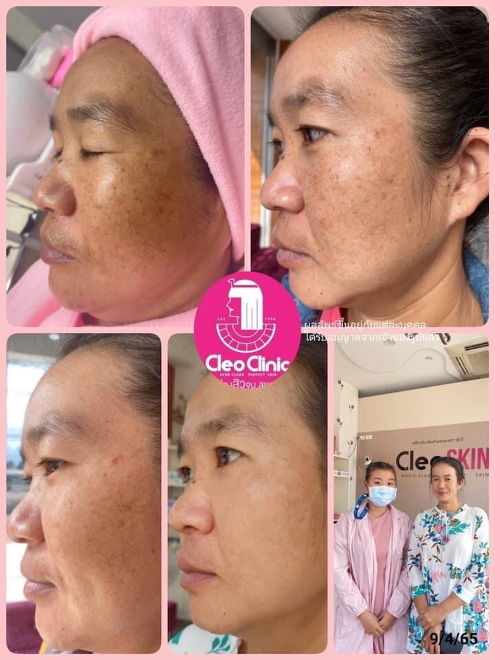 รีวิว ปี 62