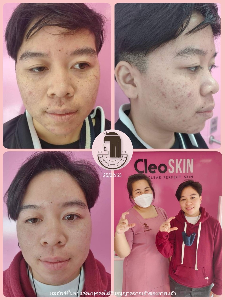 รีวิว ปี 62