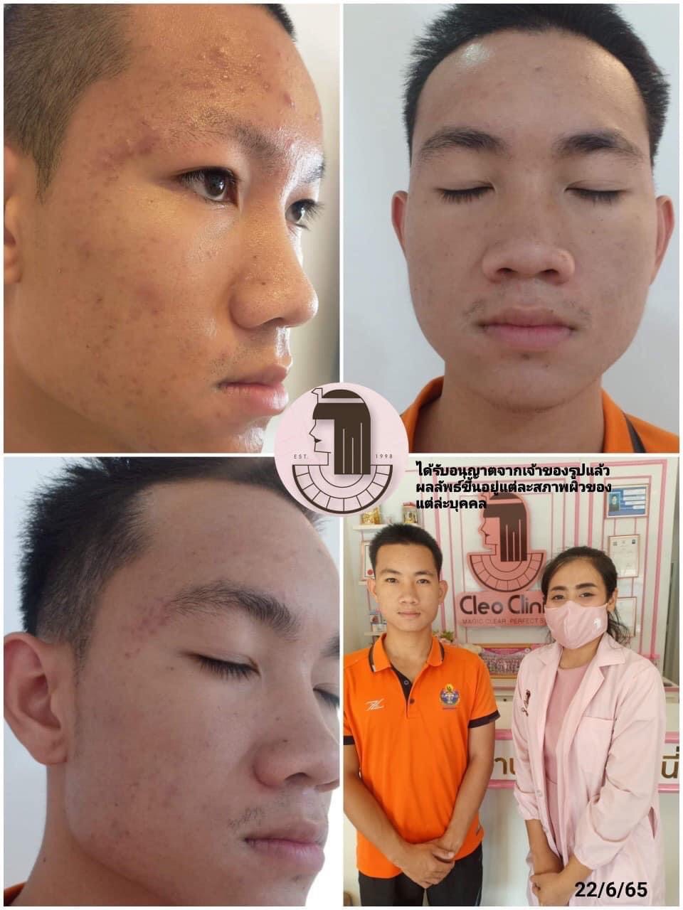 รีวิว ปี 62