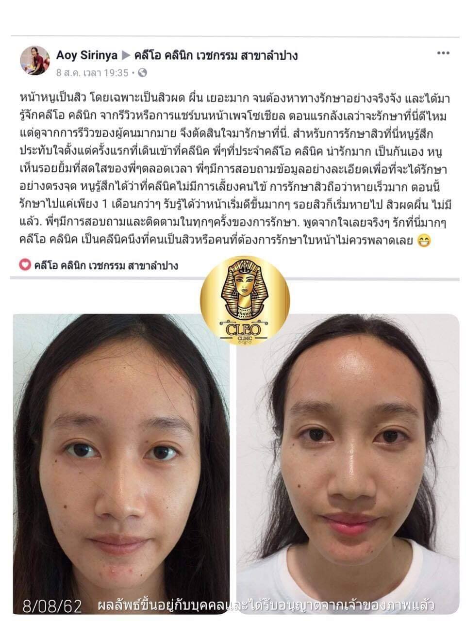 รีวิว ปี 62