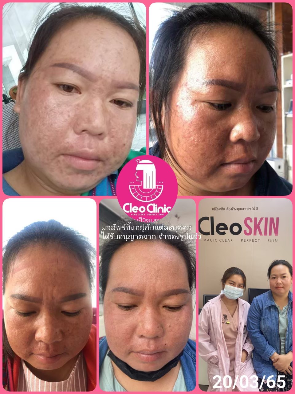 รีวิว ปี 62