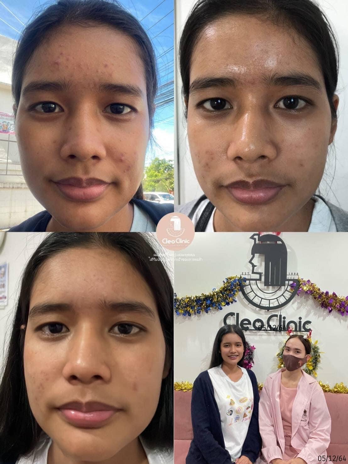 รีวิว ปี 62