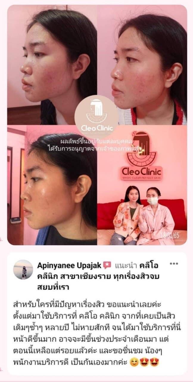 รีวิว ปี 62