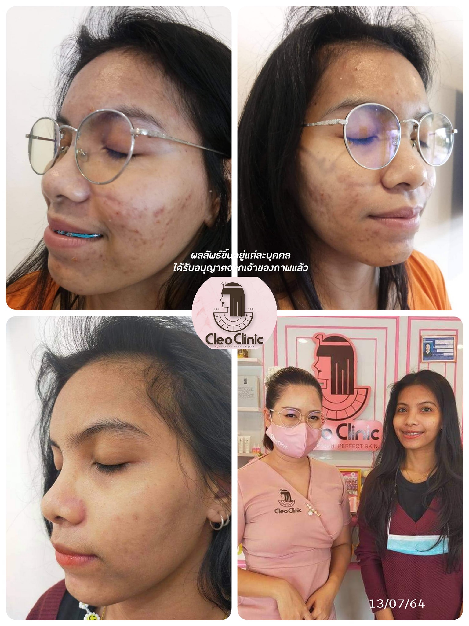 รีวิว ปี 62