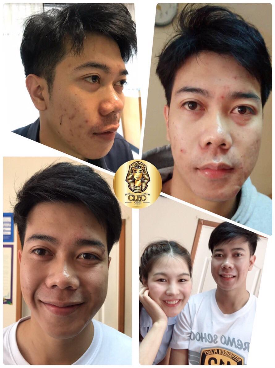 รีวิว ปี 62