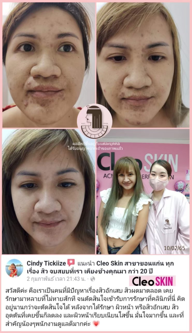 รีวิว ปี 62