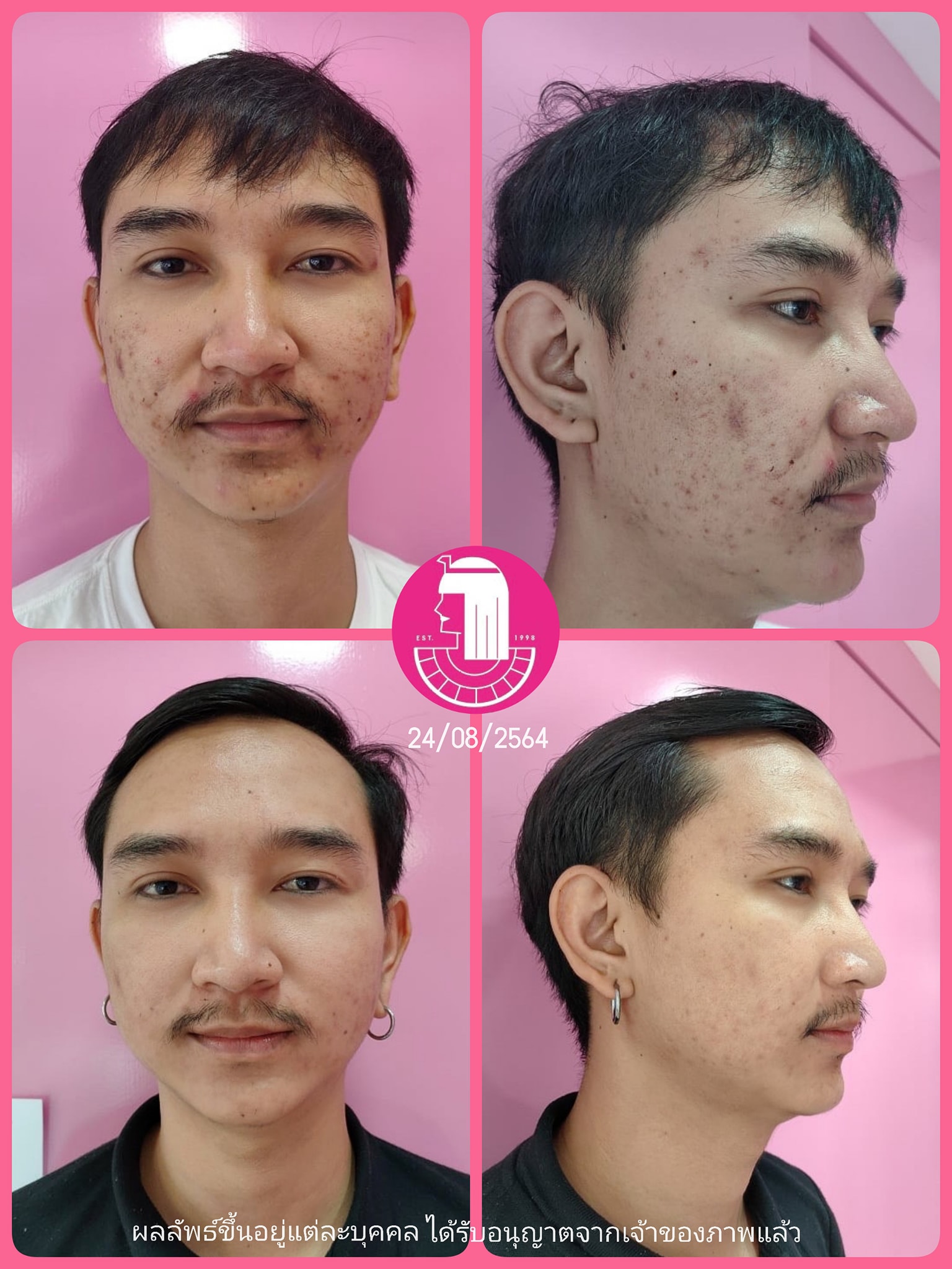 รีวิว ปี 62