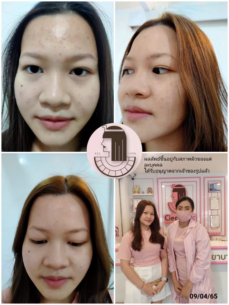 รีวิว ปี 62