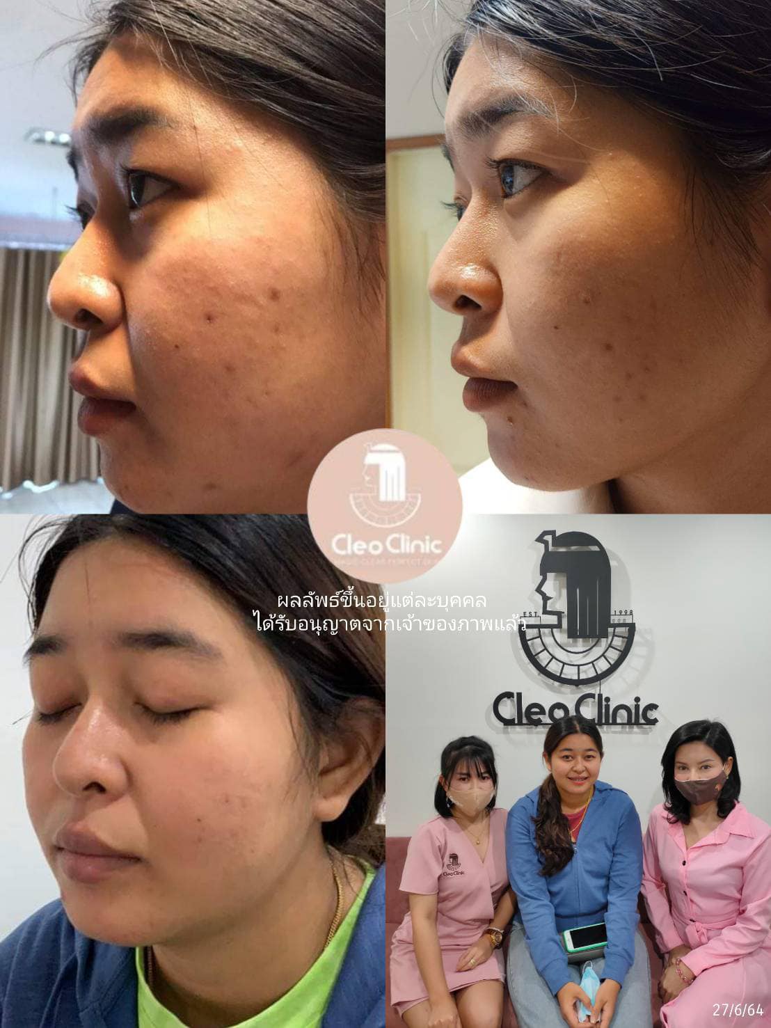 รีวิว ปี 62