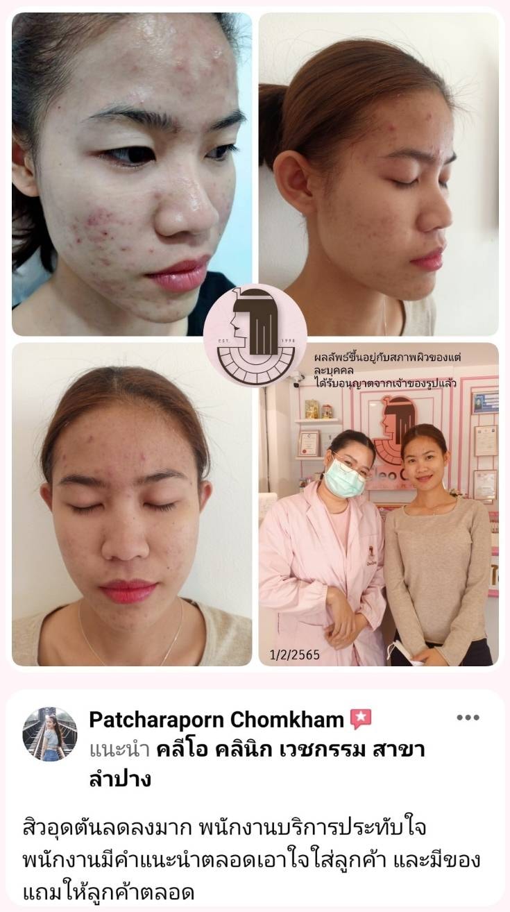 รีวิว ปี 62