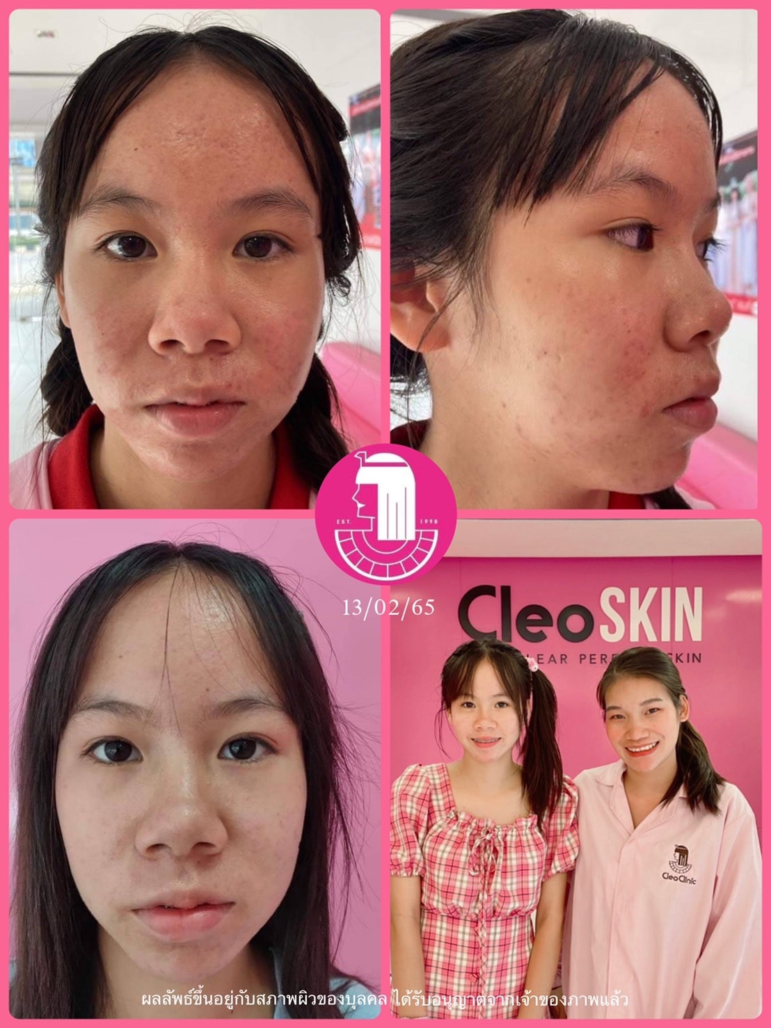 รีวิว ปี 62