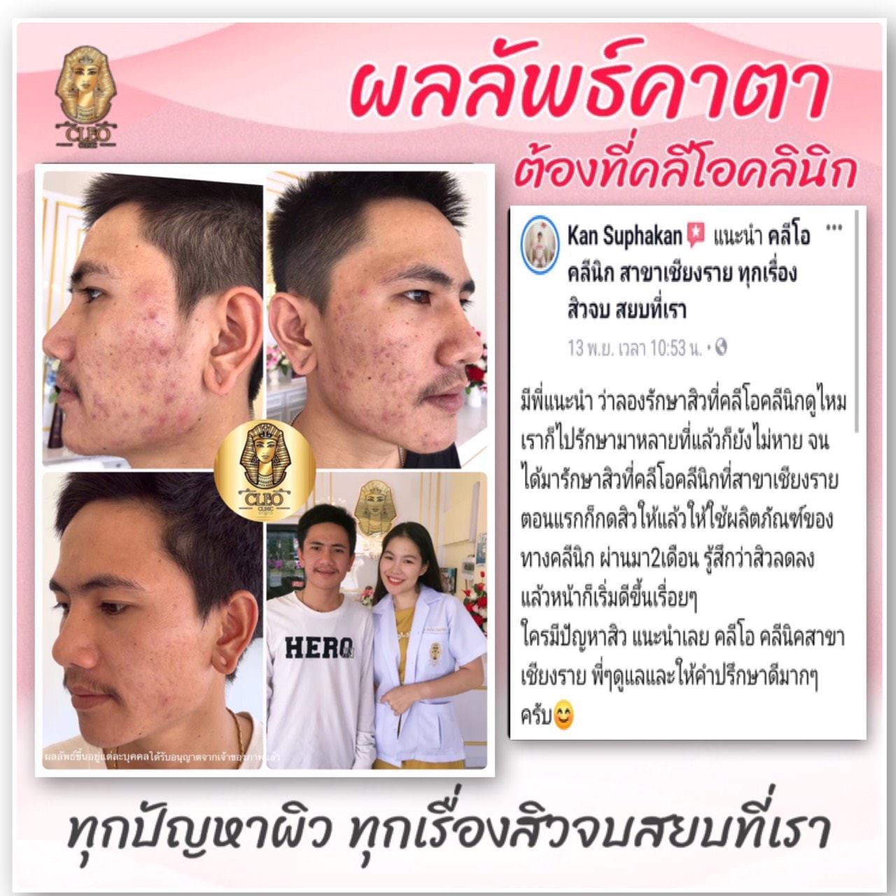 รีวิว ปี 62