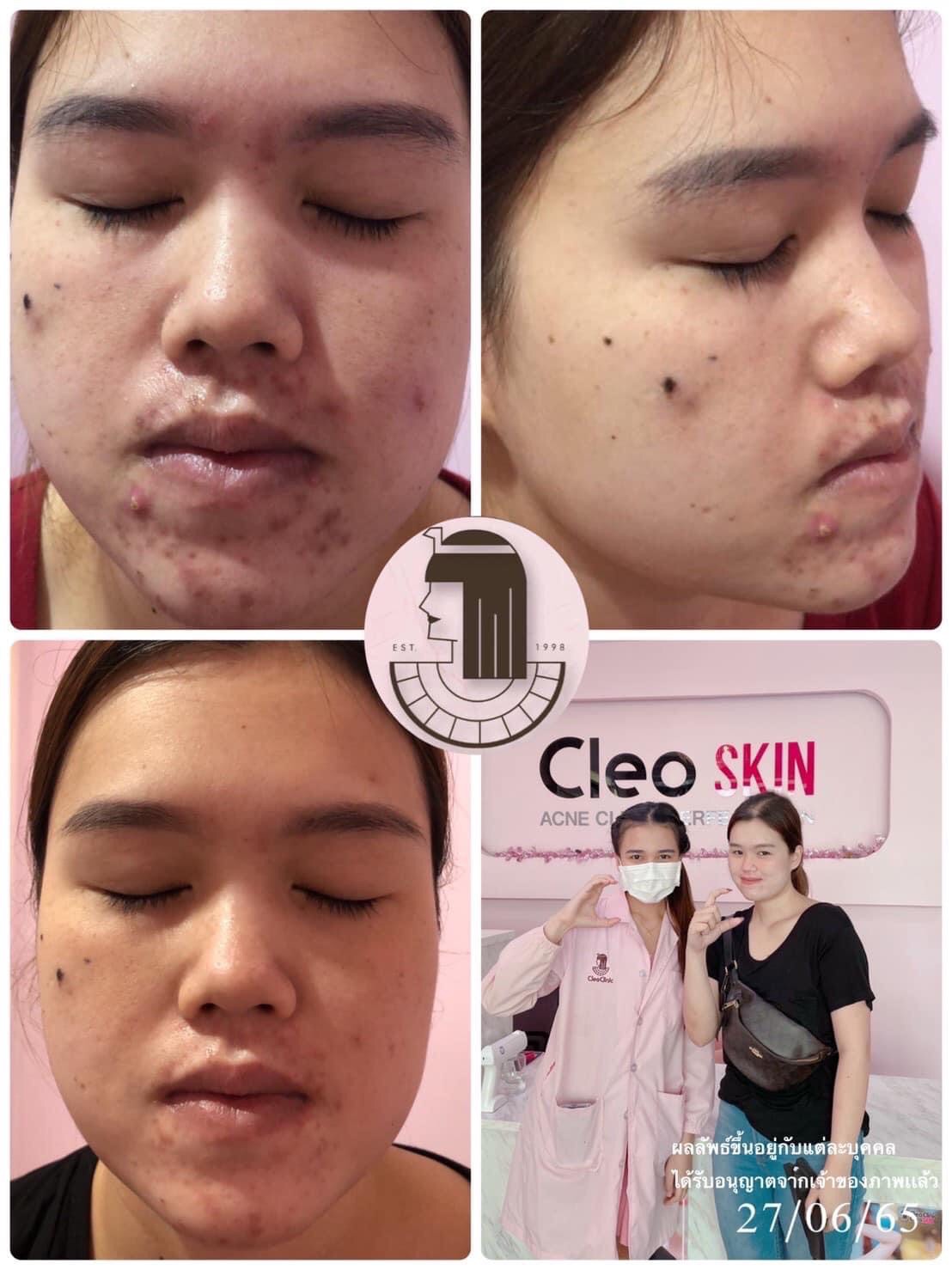 รีวิว ปี 62