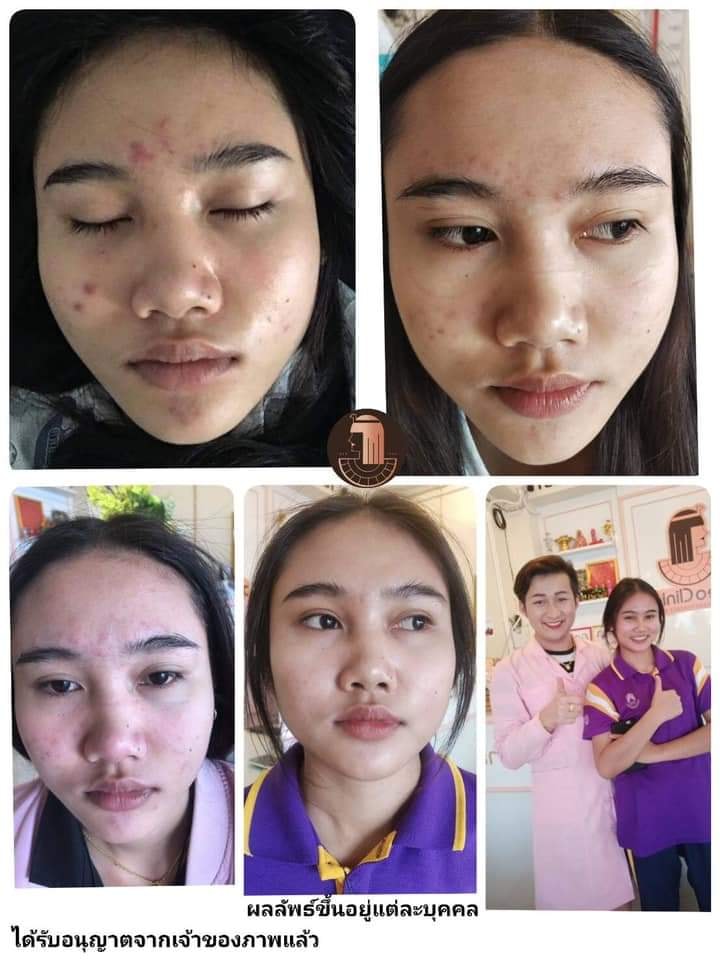 รีวิว ปี 62