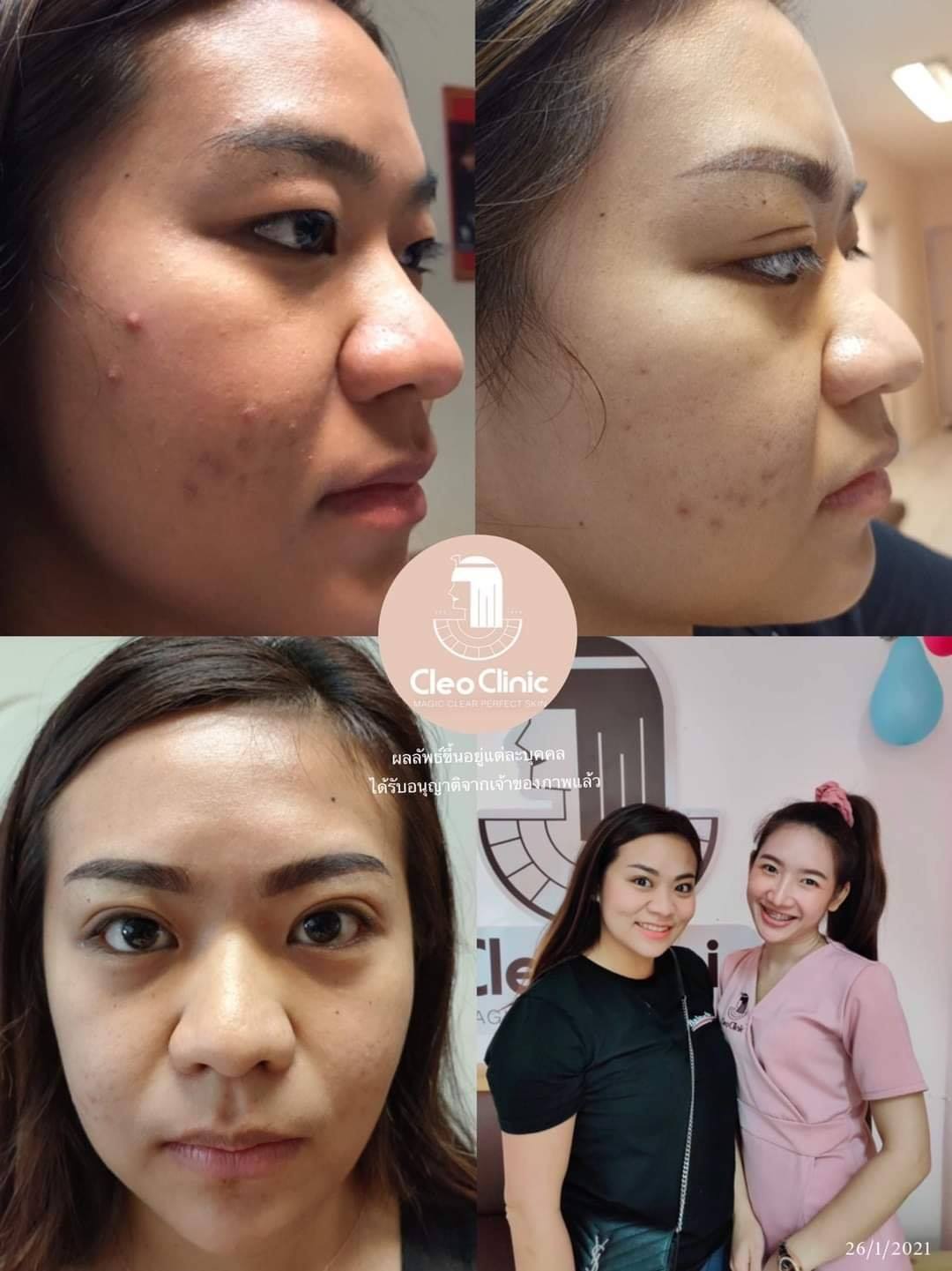 รีวิว ปี 62