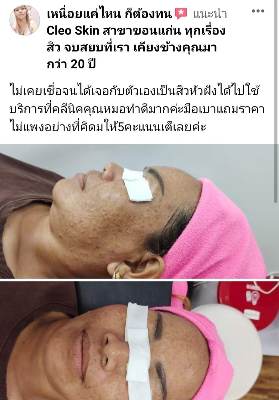 รีวิว ปี 63