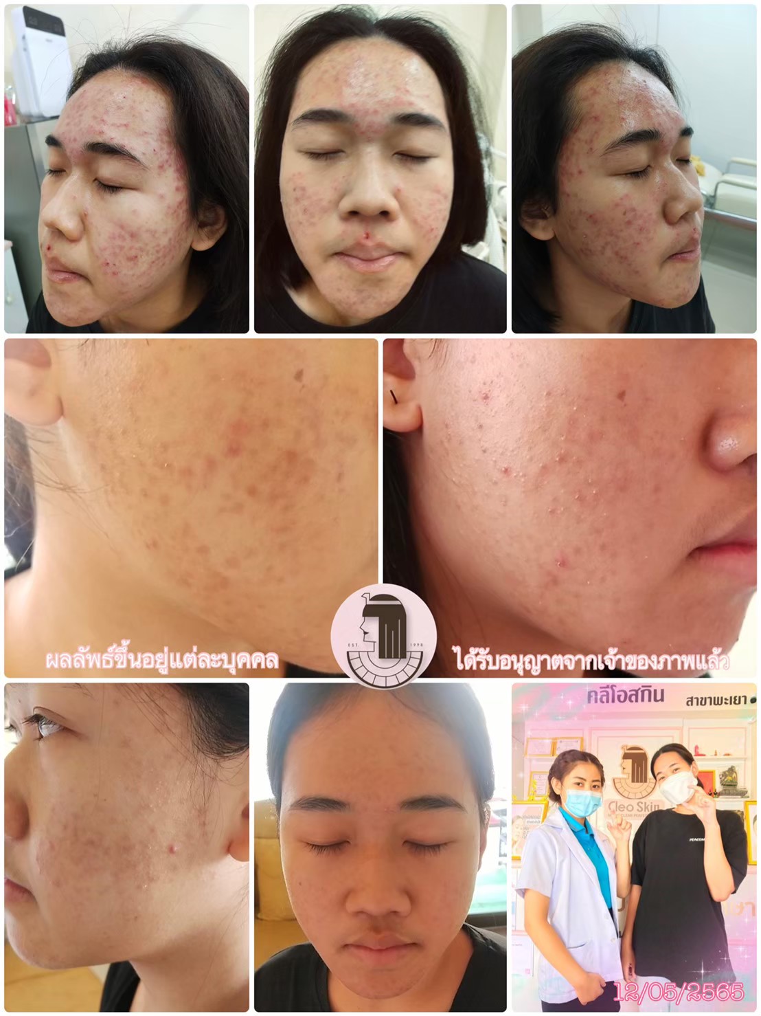 รีวิว ปี 62