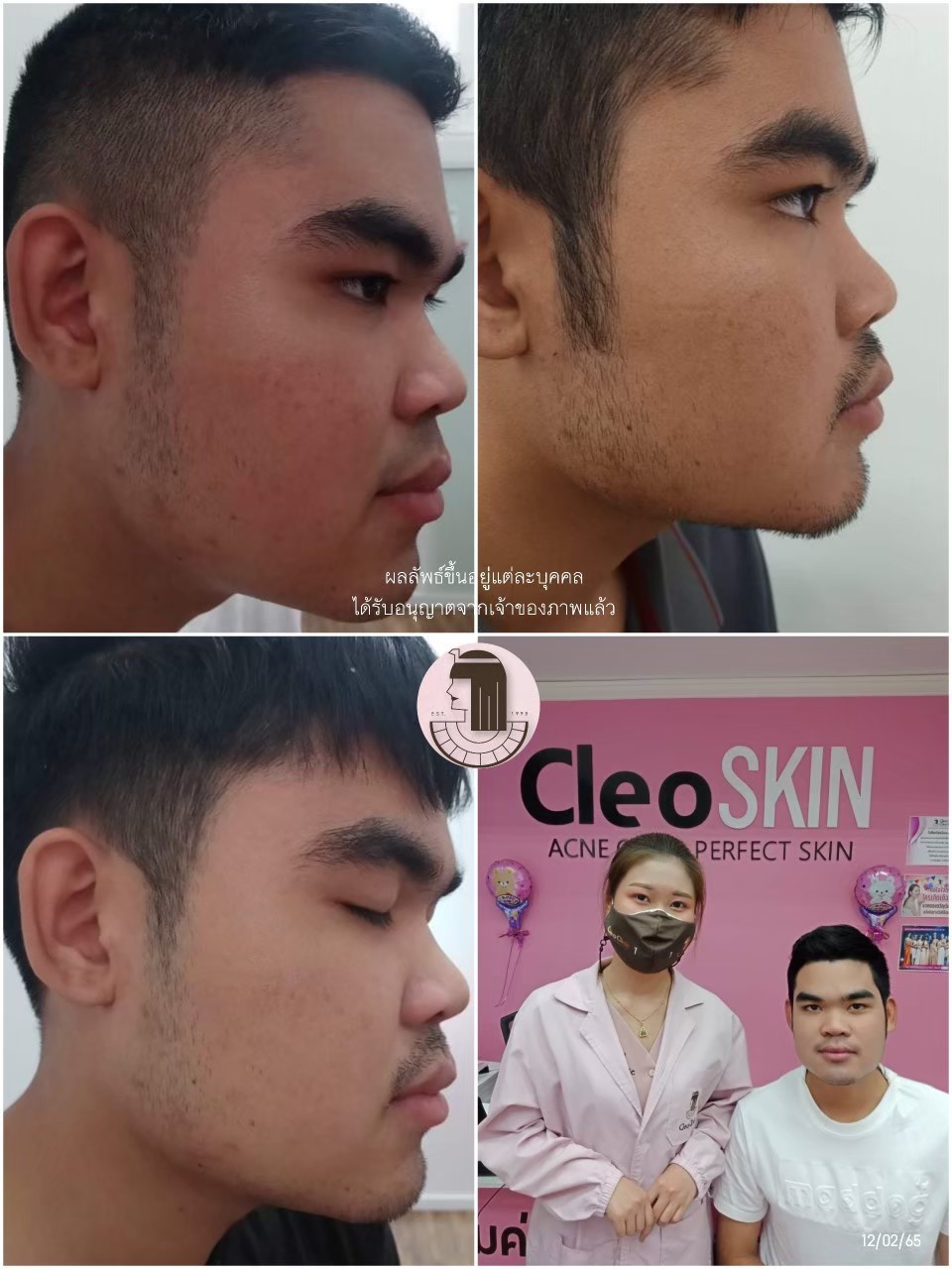 รีวิว ปี 62