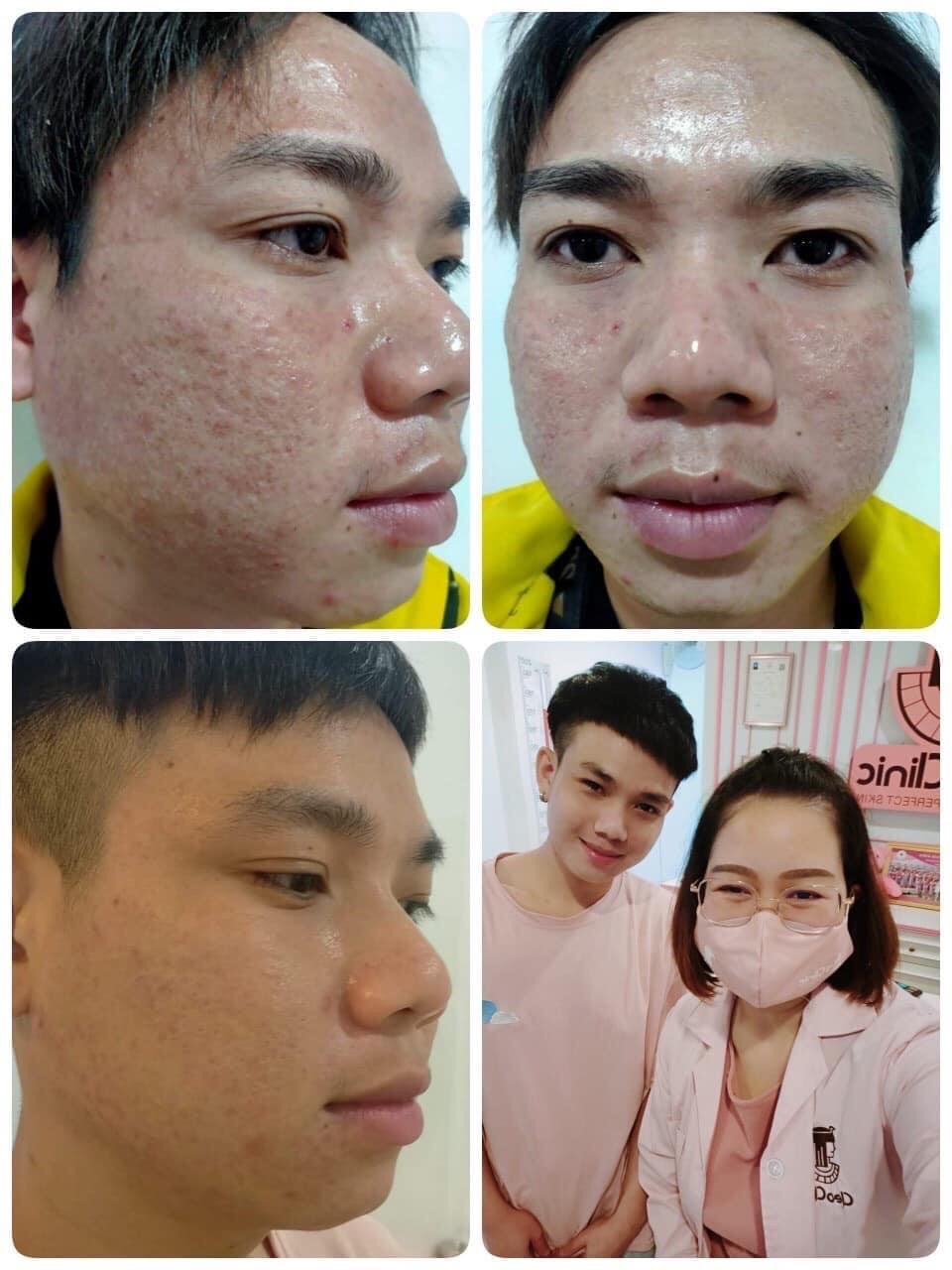 รีวิว ปี 62