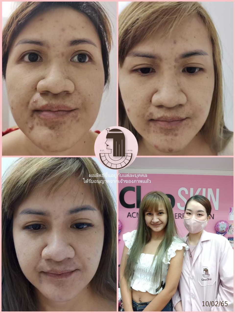 รีวิว ปี 62