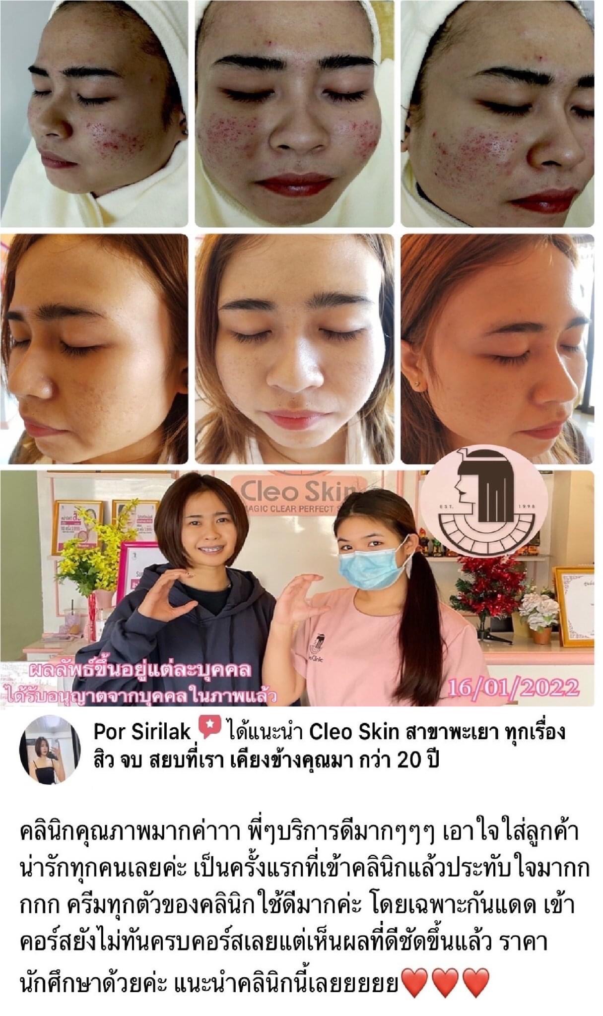 รีวิว ปี 62