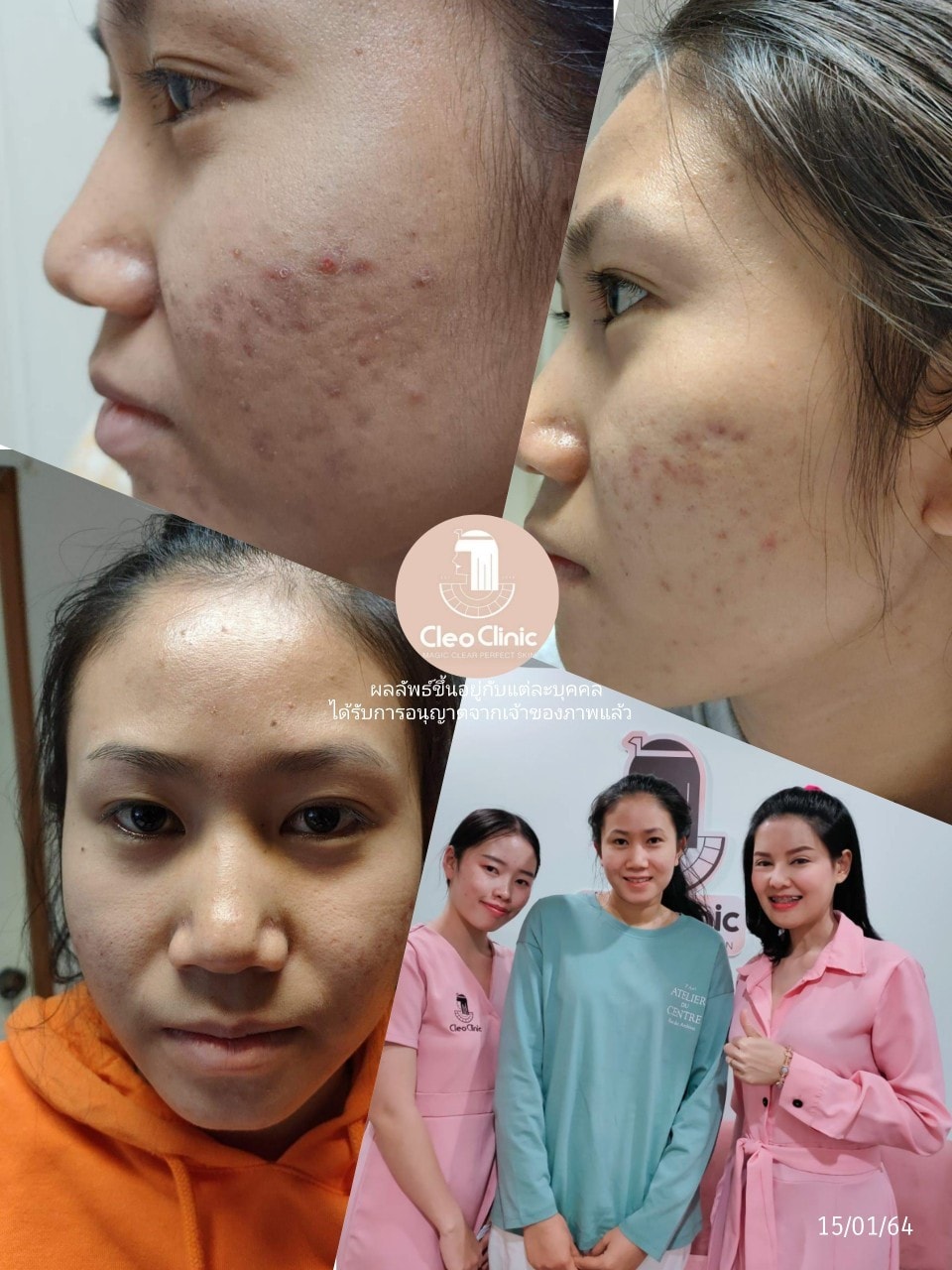 รีวิว ปี 62