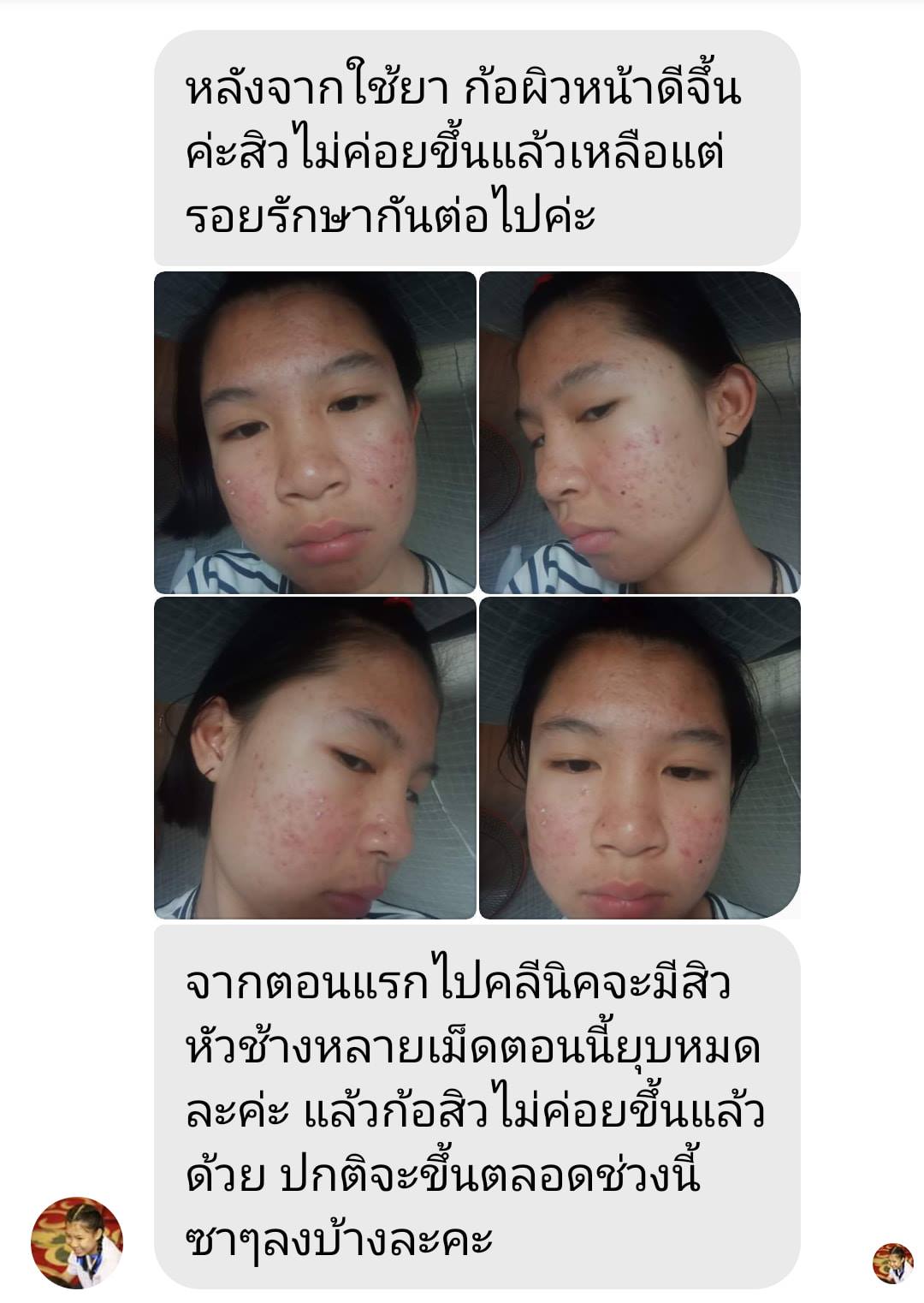 รีวิว ปี 62