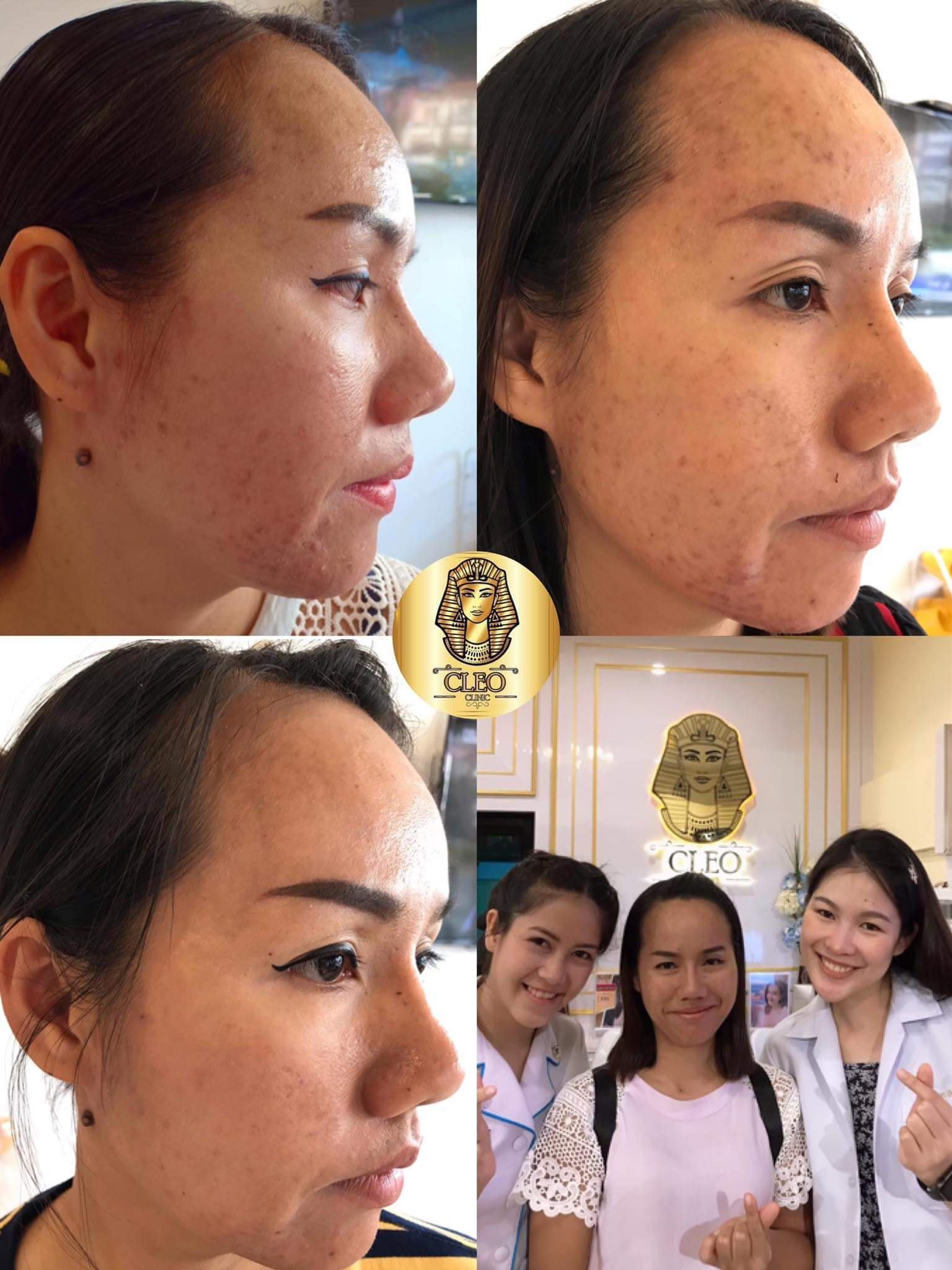 รีวิว ปี 62