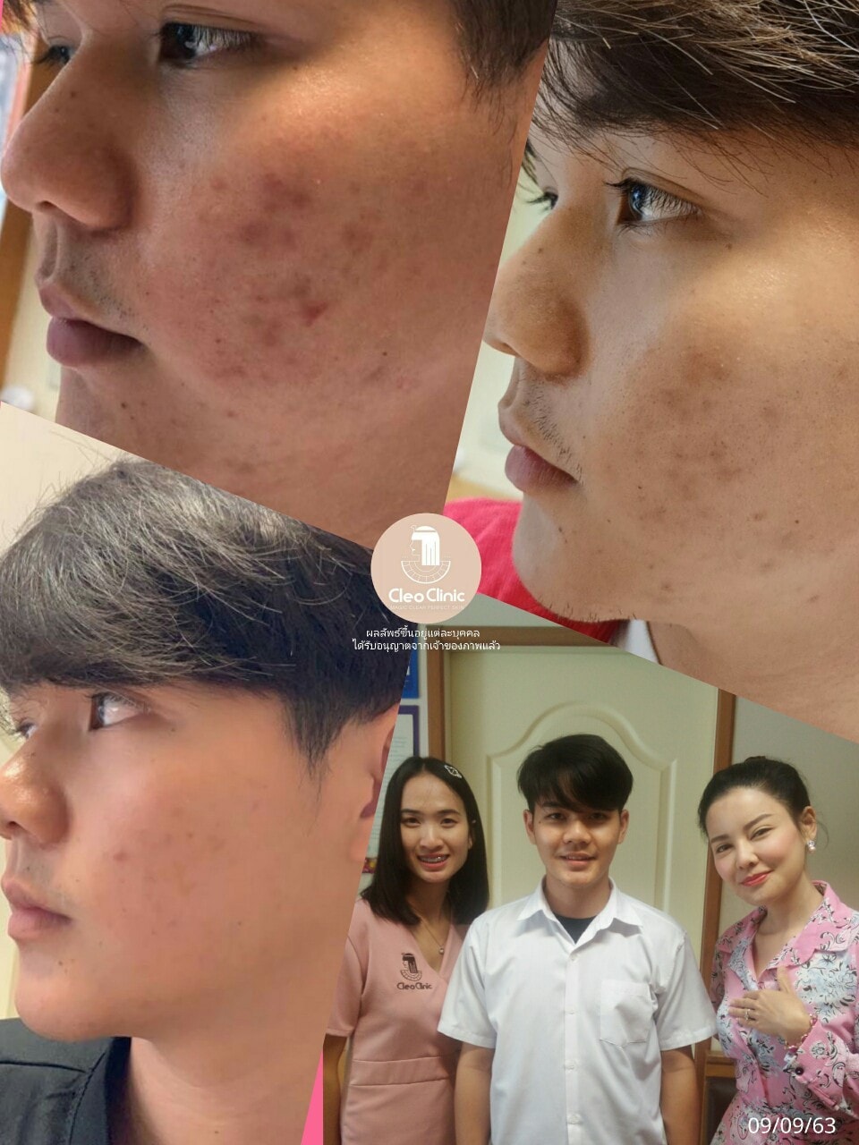 รีวิว ปี 62