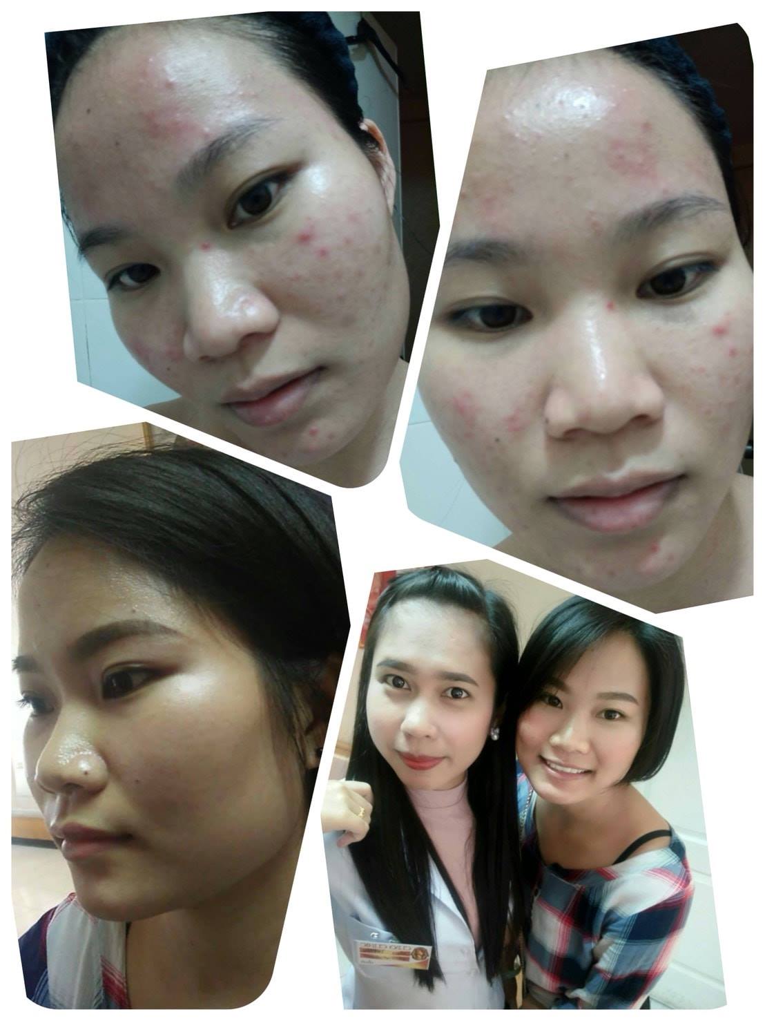 รีวิว ปี 62