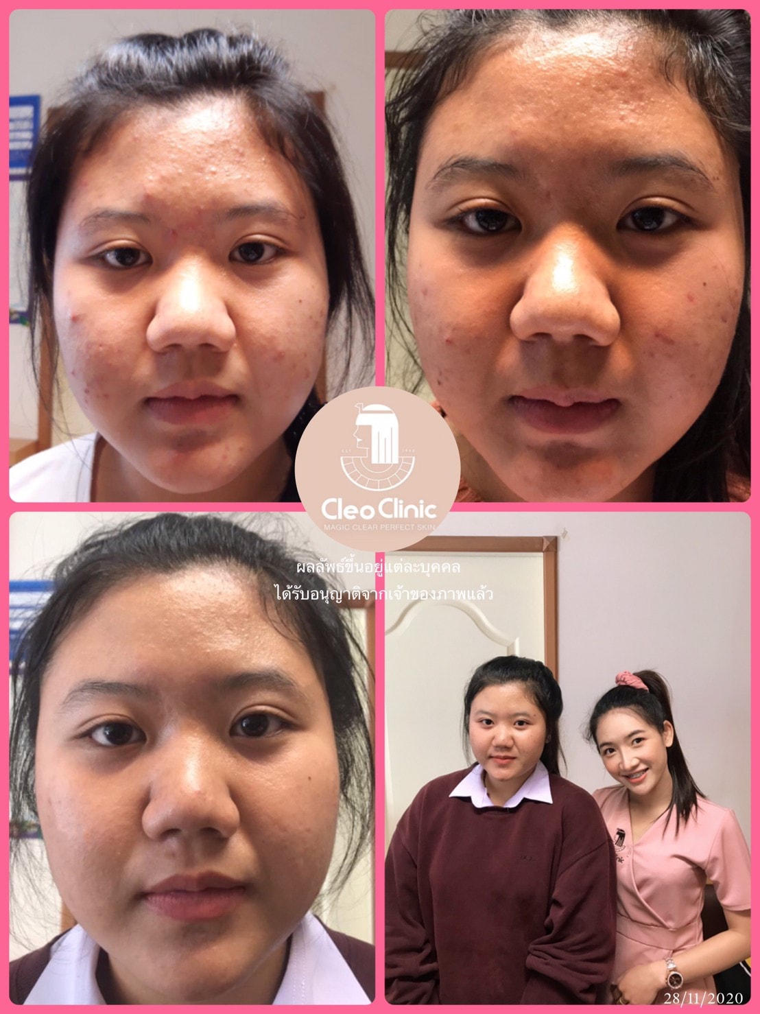 รีวิว ปี 62