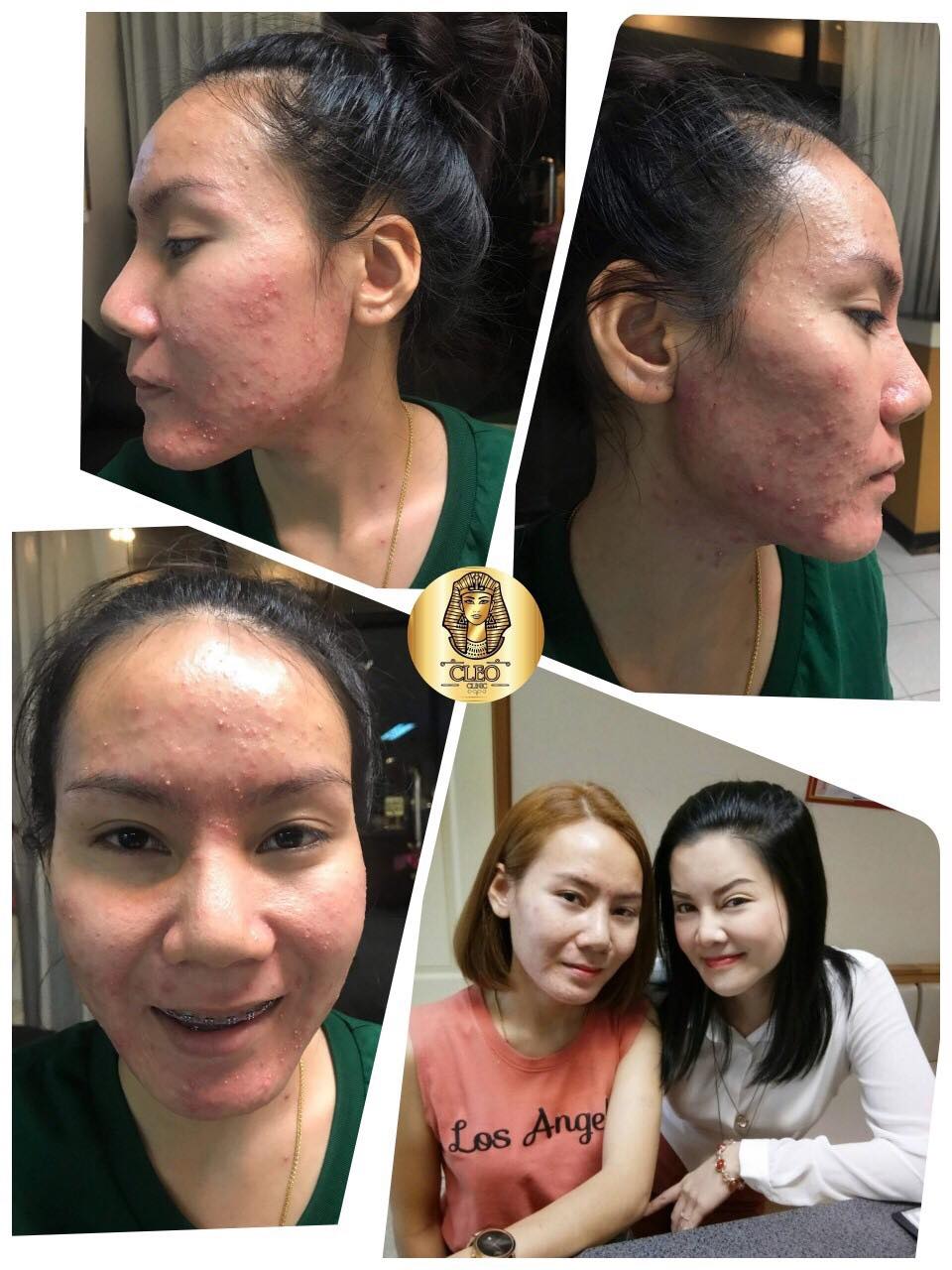 รีวิว ปี 62