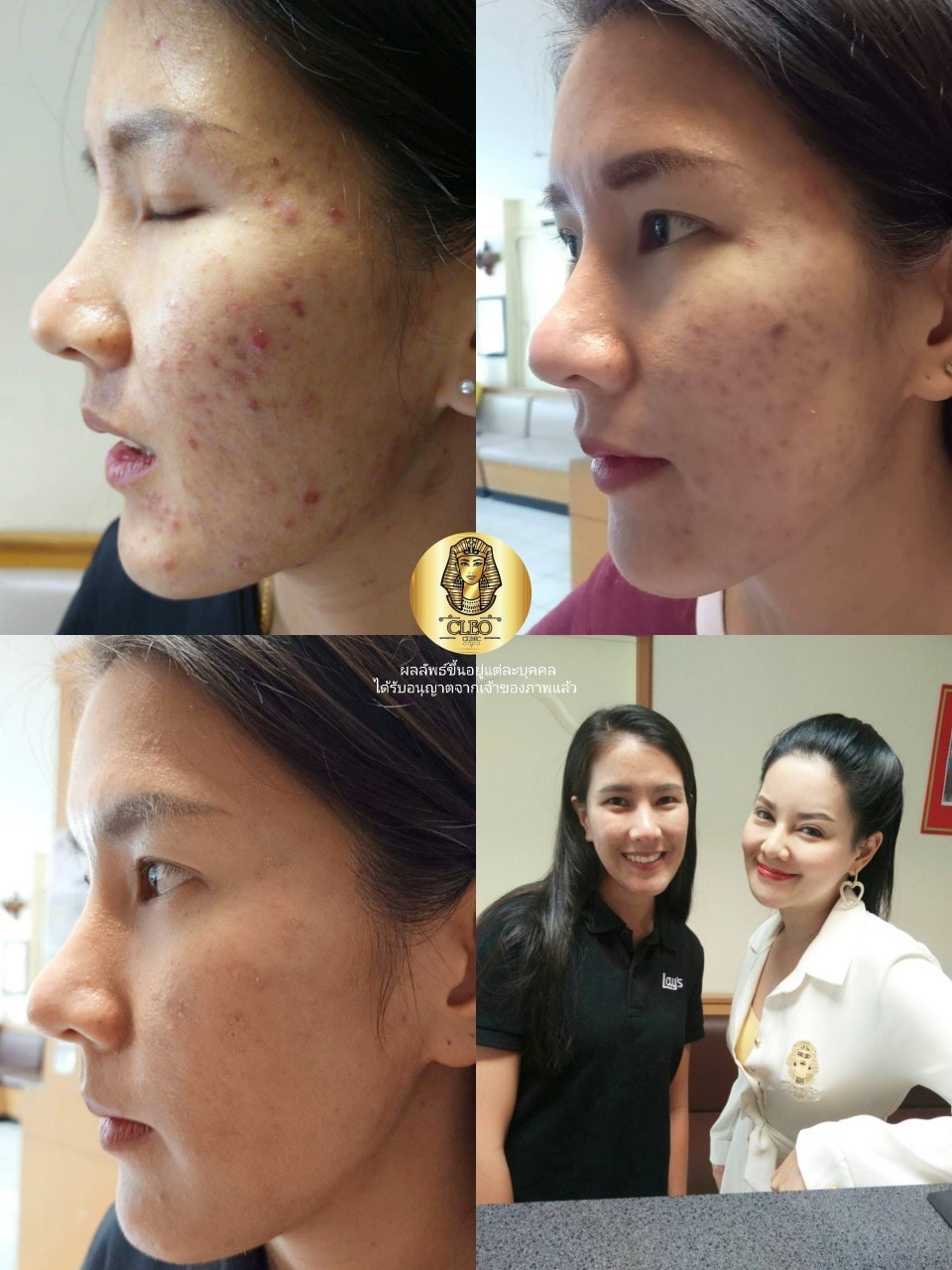 รีวิว ปี 62