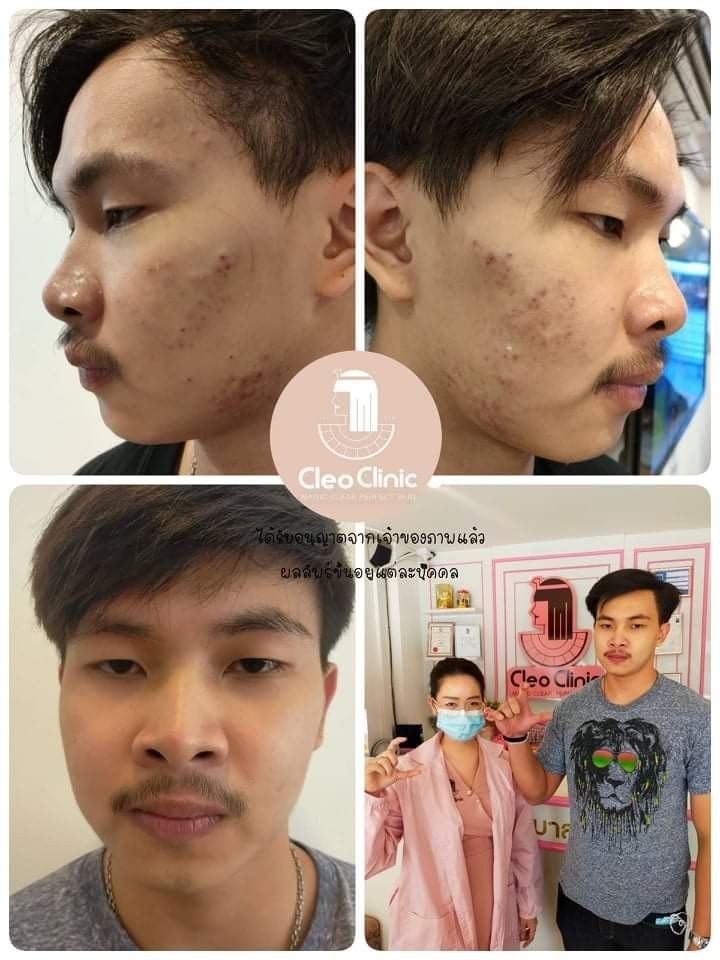 รีวิว ปี 62