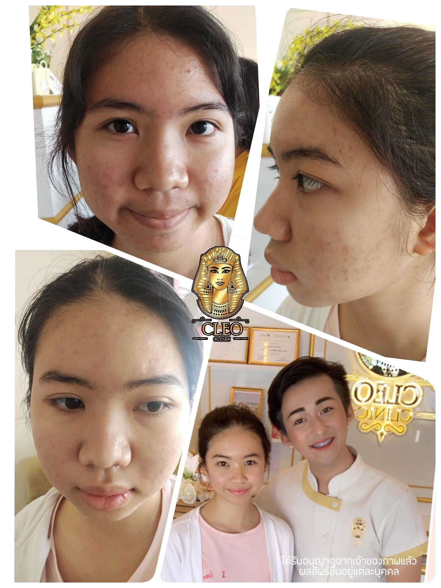 รีวิว ปี 62