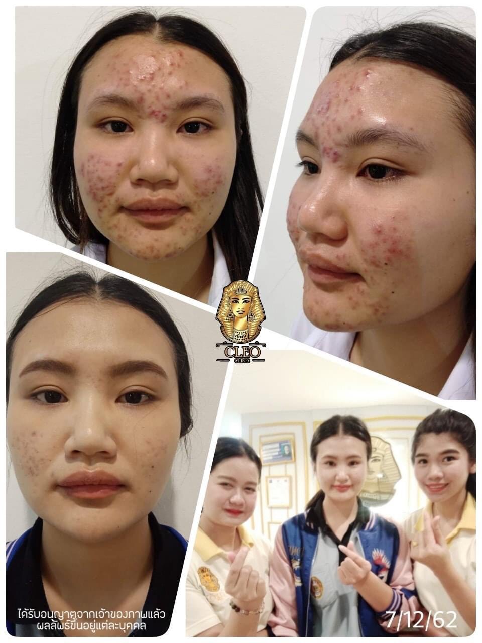 รีวิว ปี 62