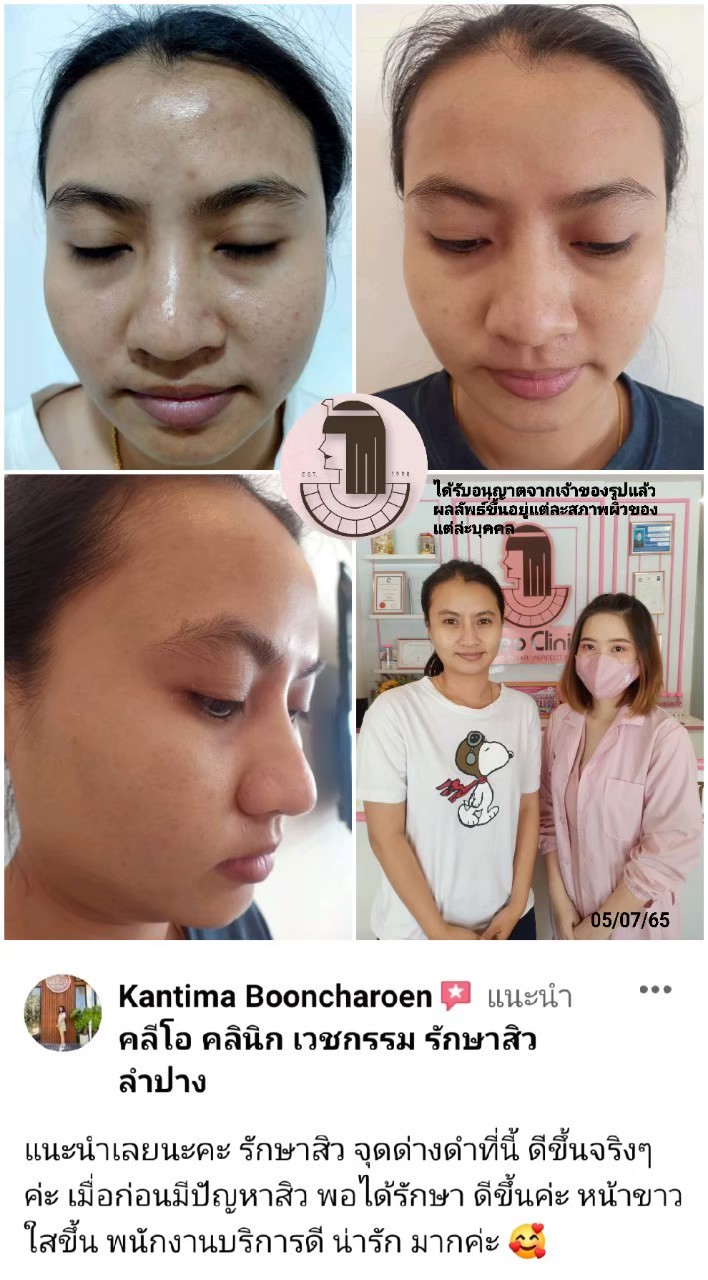 รีวิว ปี 62