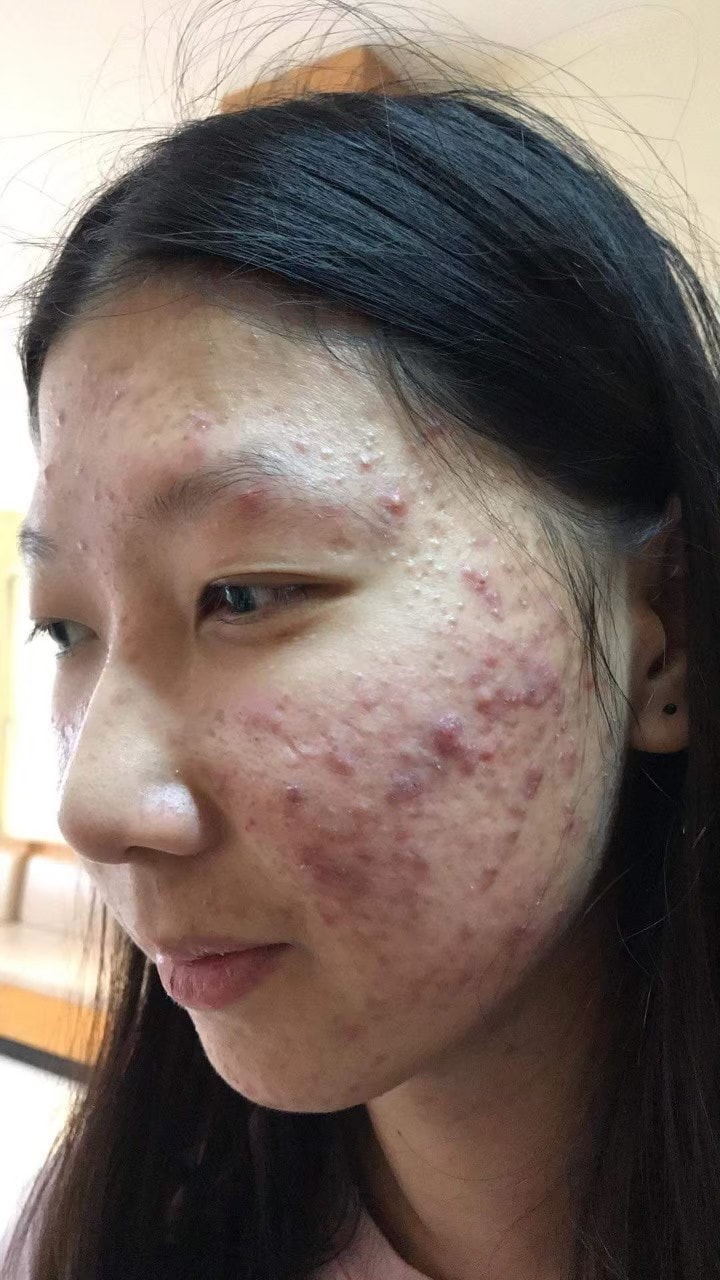 รีวิว ปี 62