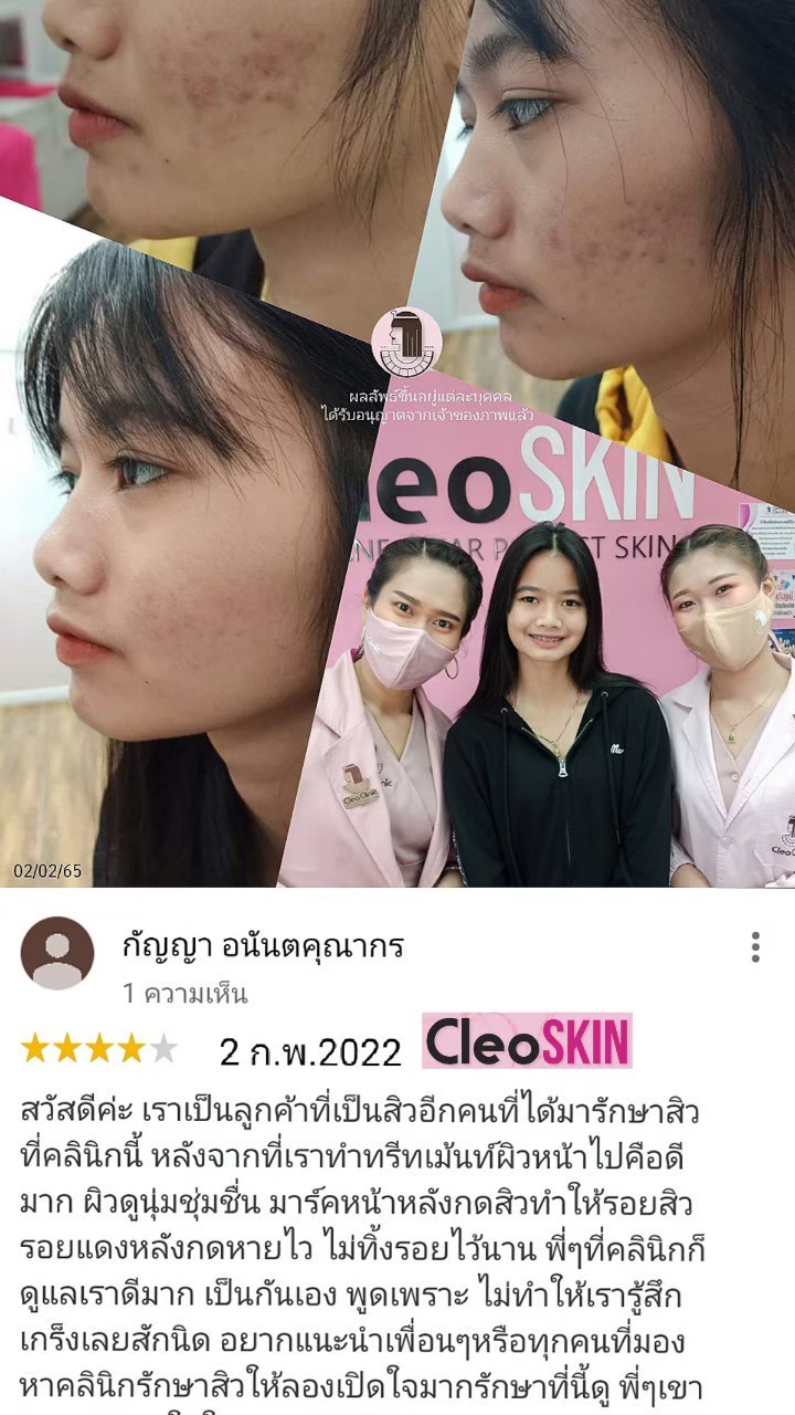 รีวิว ปี 62