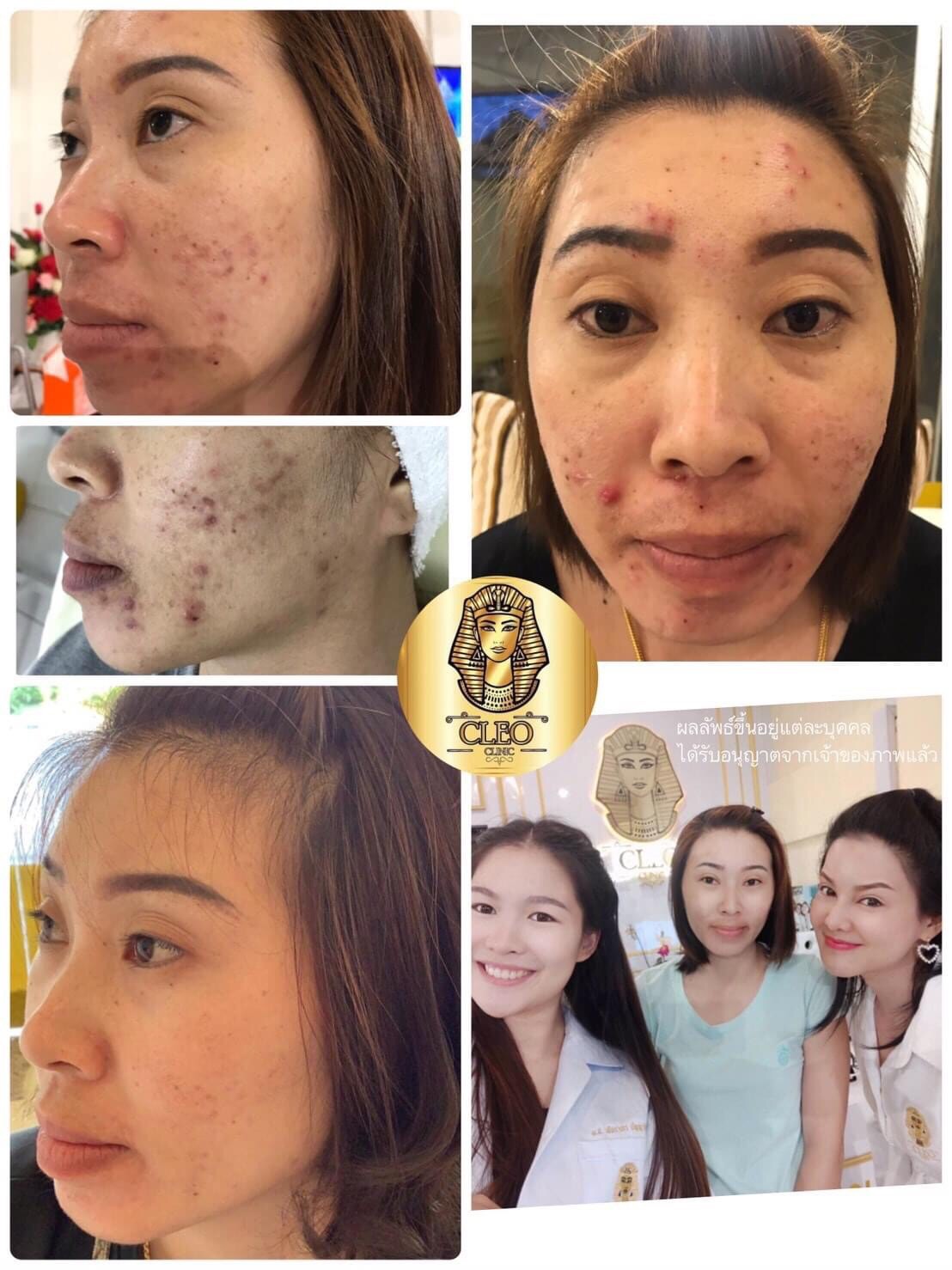 รีวิว ปี 62