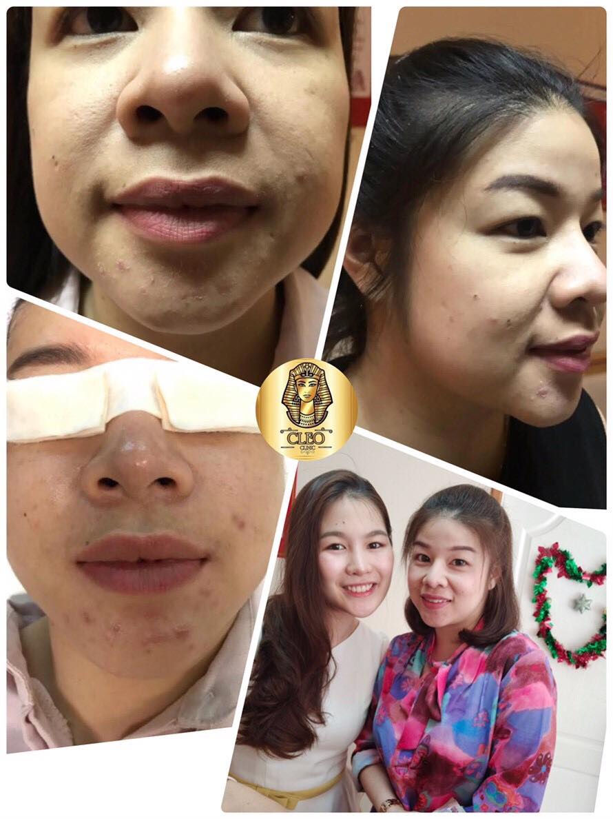 รีวิว ปี 62