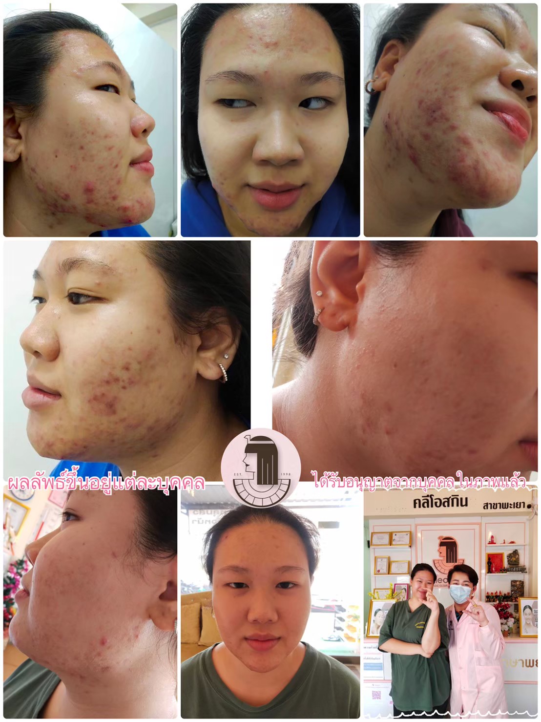 รีวิว ปี 62