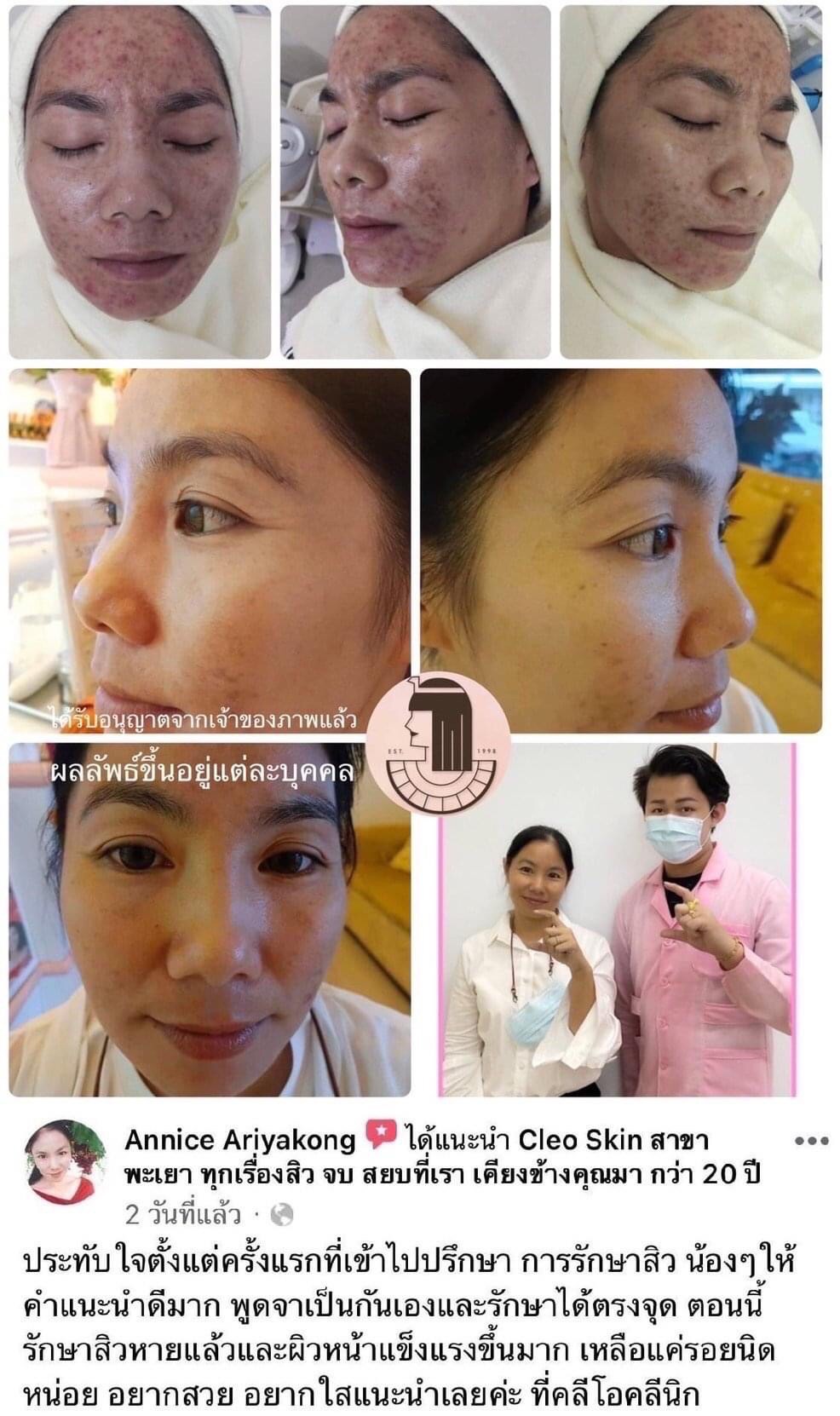 รีวิว ปี 62