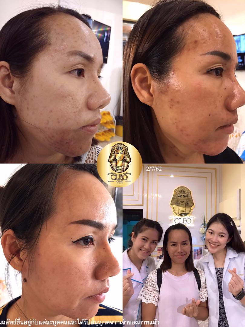 รีวิว ปี 62