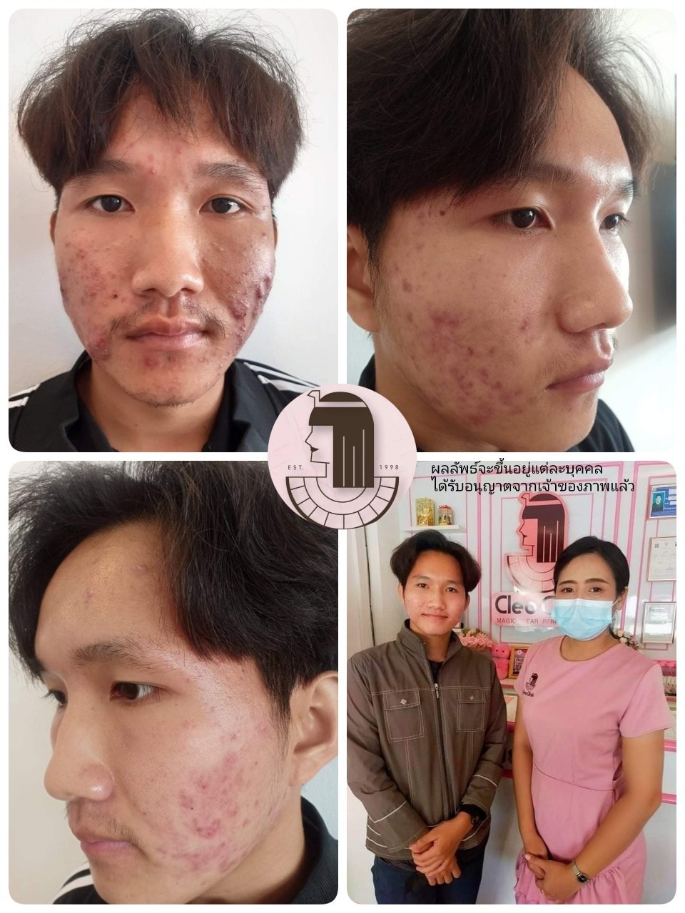 รีวิว ปี 62