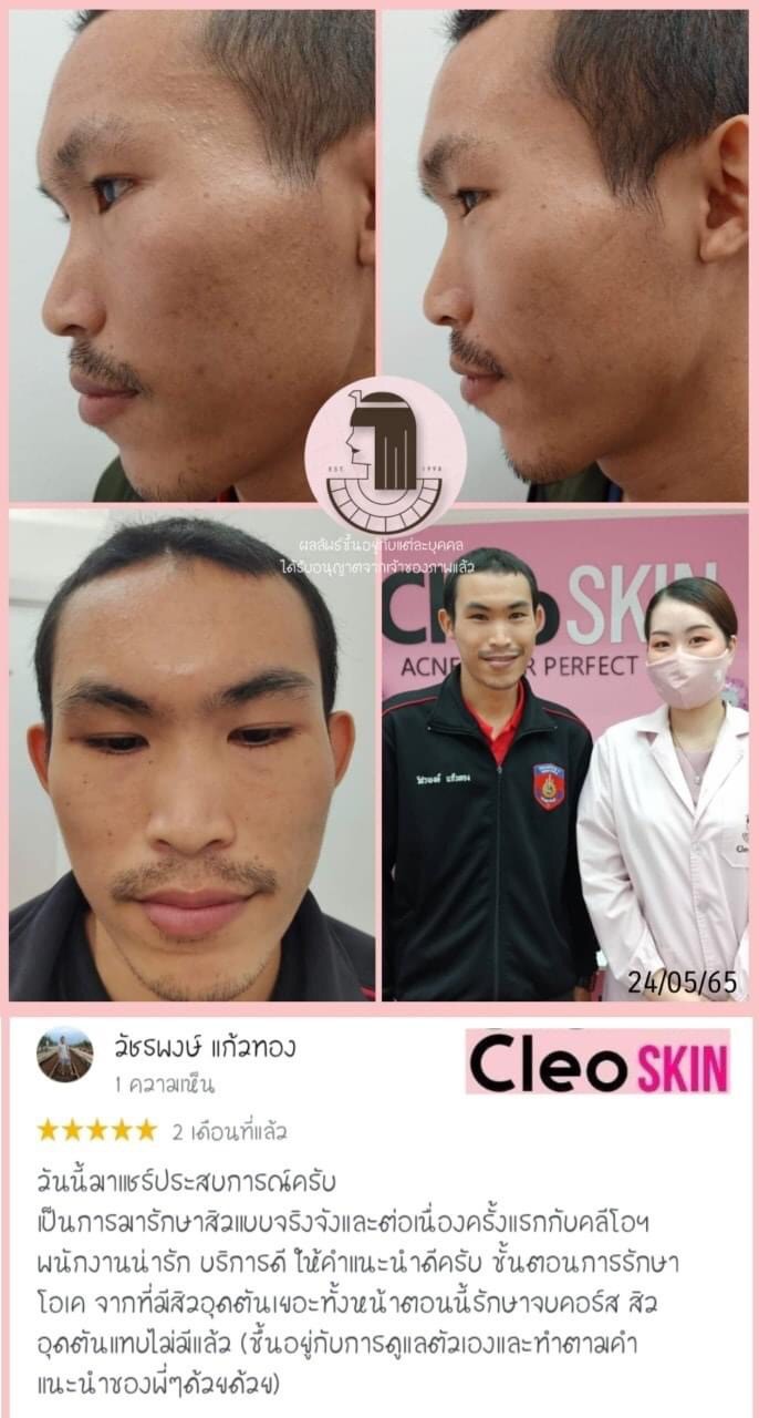 รีวิว ปี 62