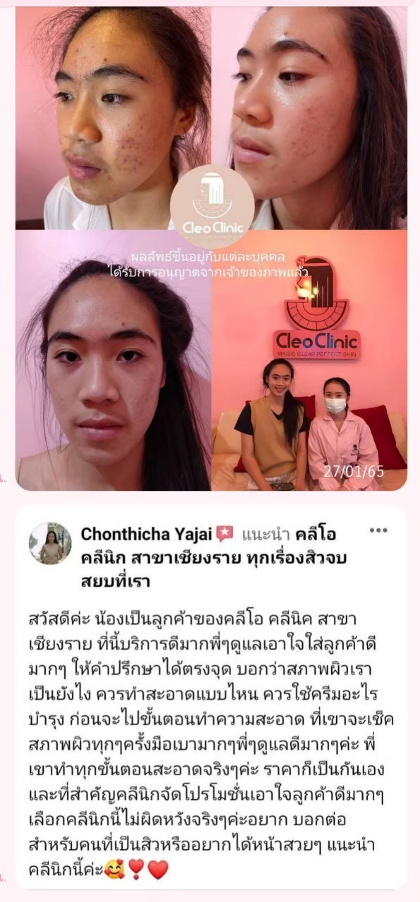 รีวิว ปี 62