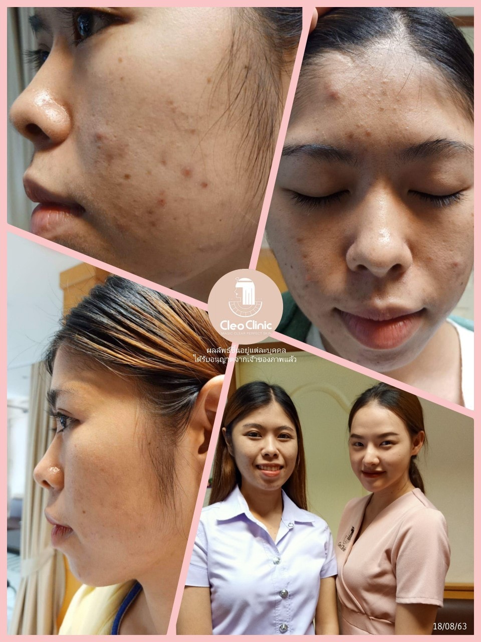 รีวิว ปี 62