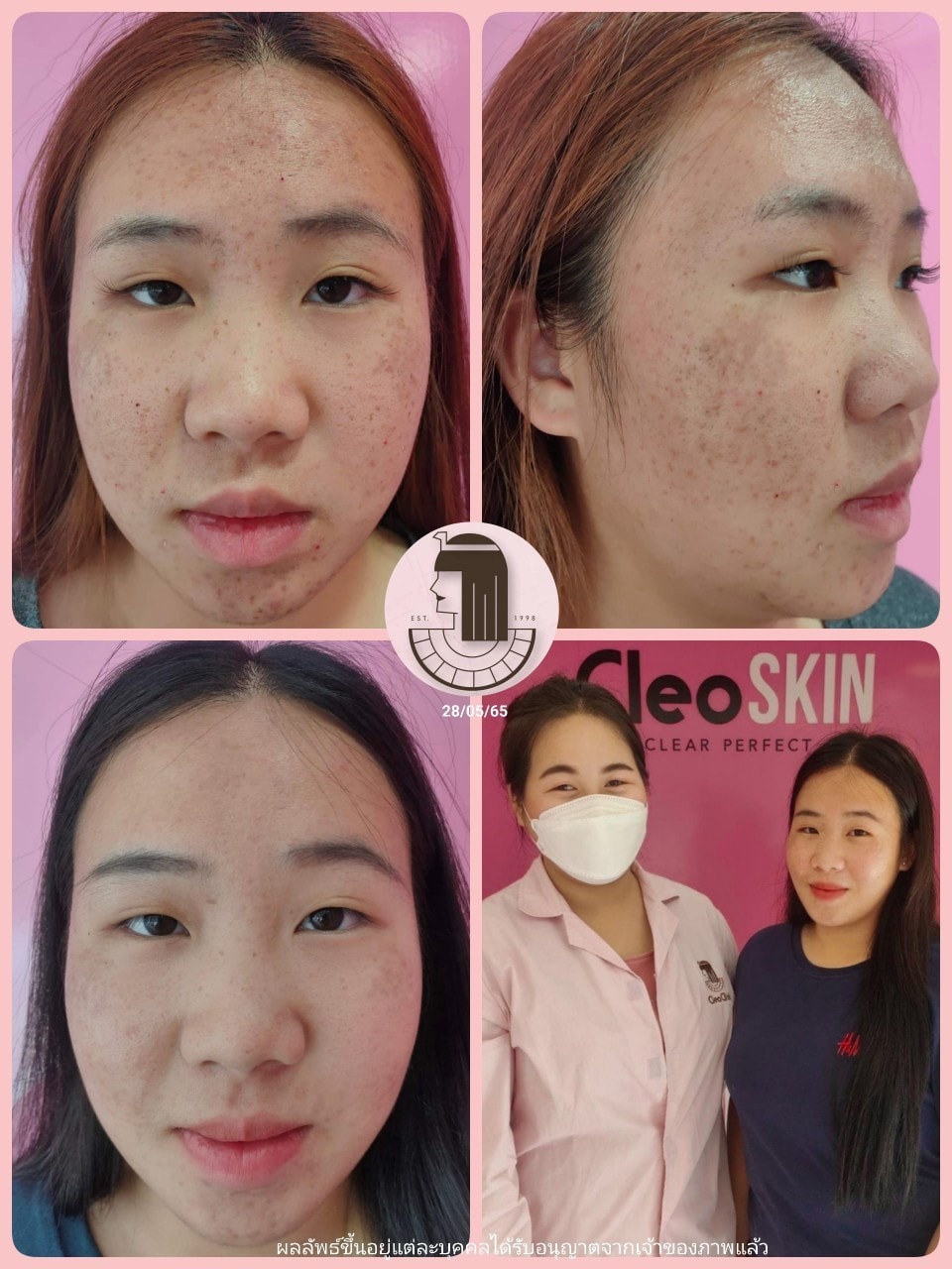 รีวิว ปี 62