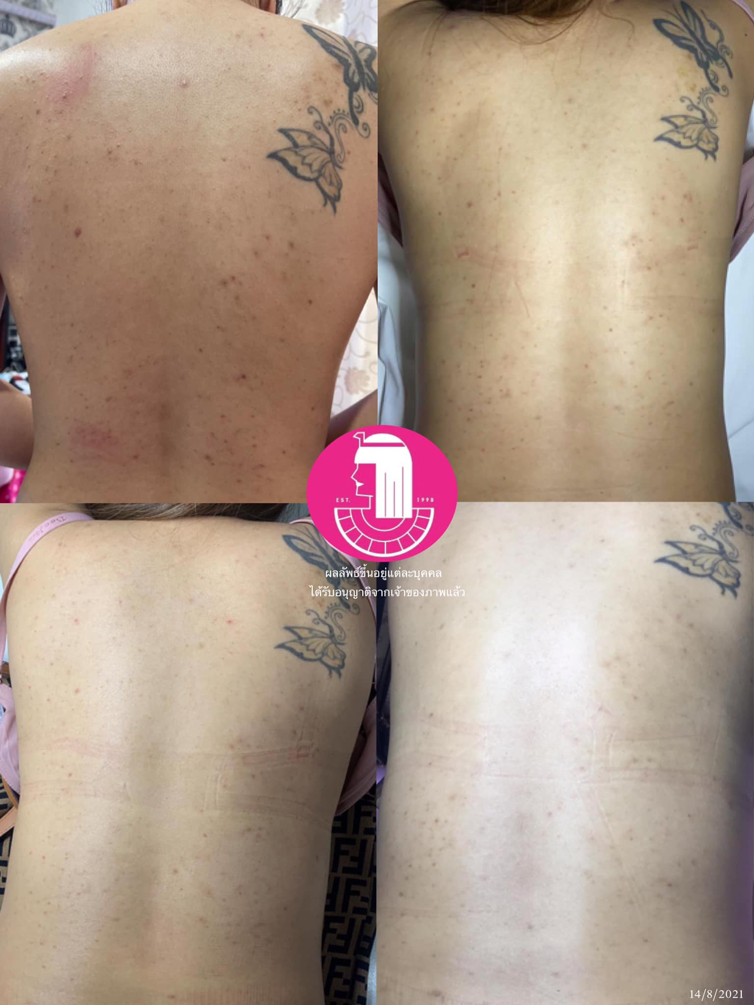 รีวิว ปี 62